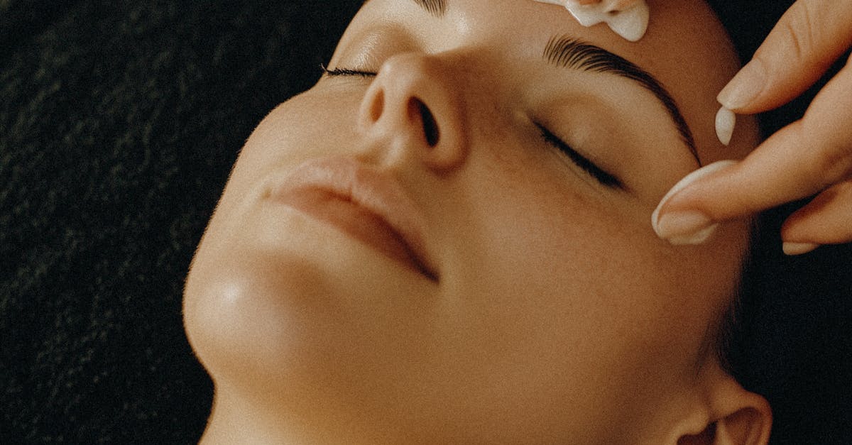 Akne ve Sivilce Tedavisi