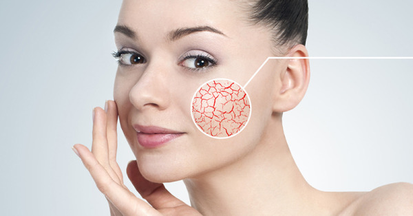 Kılcal Damar Tedavisi